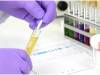The Importance of Pre-Employment Drug Testing: Ensuring a Reliable Workforce