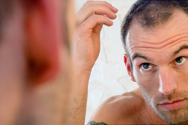 Natural Hair Loss Treatment for Men – It Is Very Simple and Easy to Apply Them