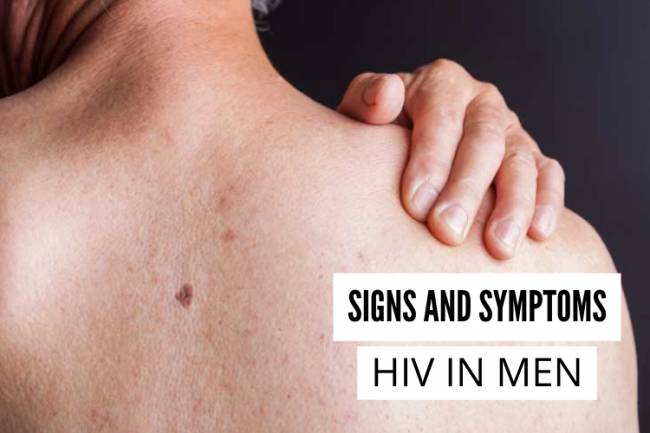 Signs and Symptoms of HIV in Men