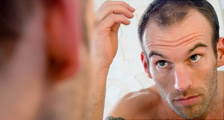 Natural Hair Loss Treatment for Men – It Is Very Simple and Easy to Apply Them
