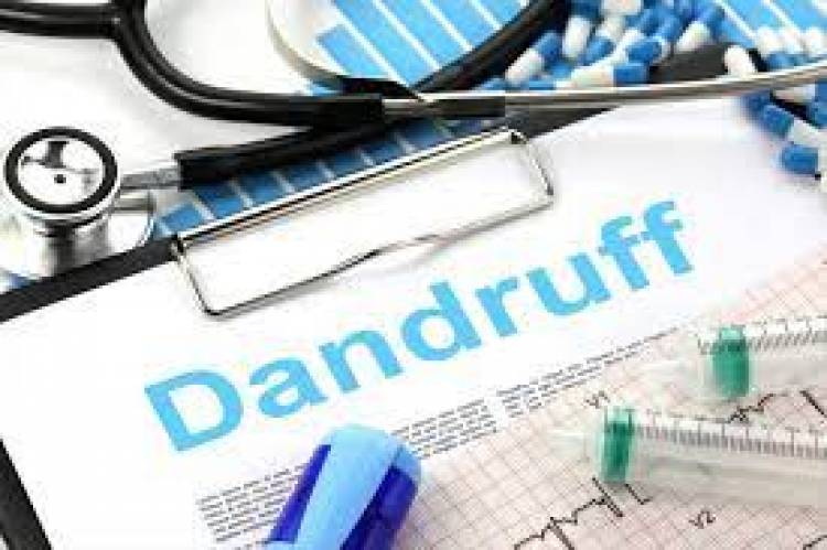 Dealing With Dandruff